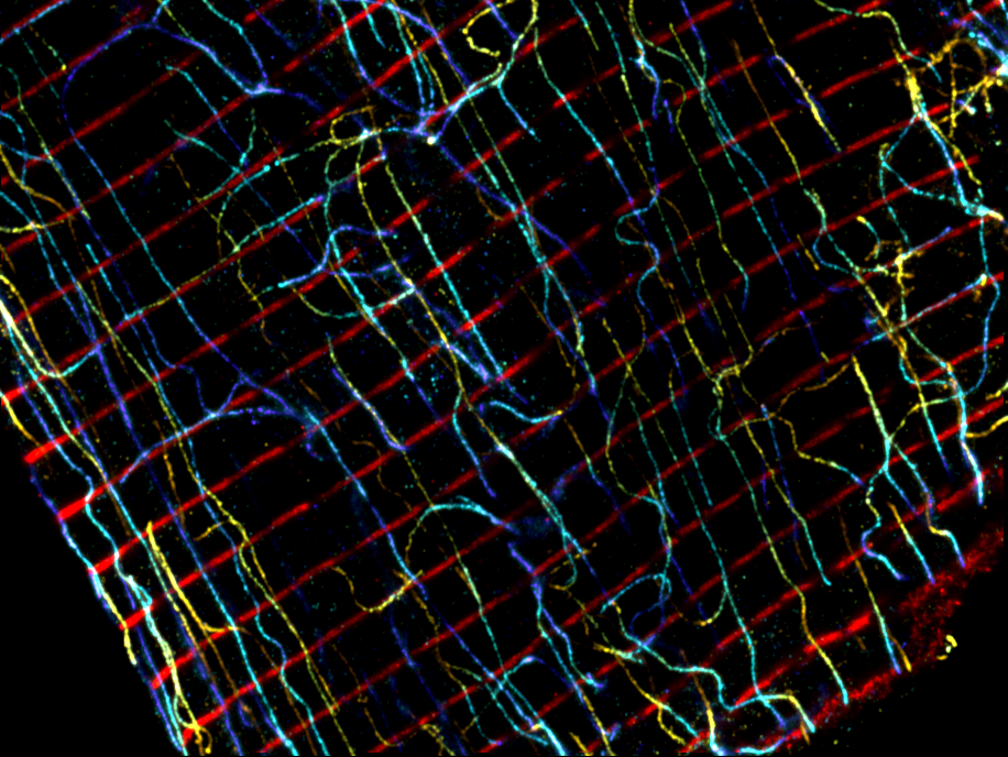 Cardiomyocyte