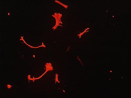 Human astrocytes