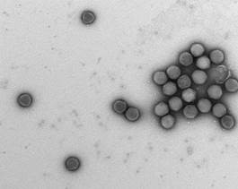 Electron micrograph of recombinant adenoviruses (courtesy of Dr. Eric Blair)