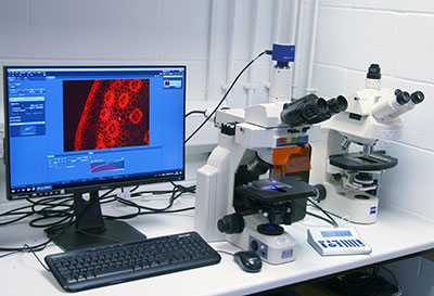 Epi fluorescence microscope TL
