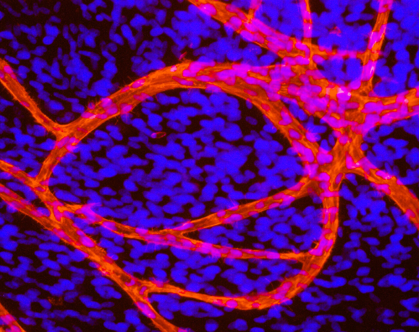 Endothelial tubules