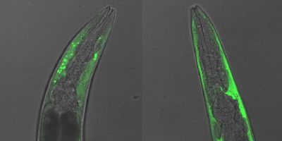 The head region of a C. elegans worm with potentially harmful aggregations of alpha-synuclein (tagged with green fluorescence).