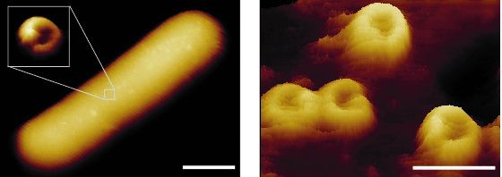 Hole-forming nanomachines – so-called membrane attack complexes – imaged on the back of a bacterium. The scale bars correspond to 800 (left) and 30 (right) nanometres. Source: EMBO Journal (2019)