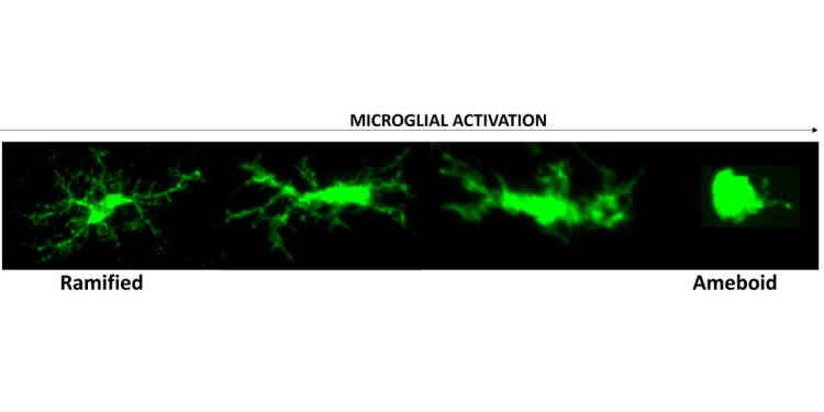 Microglia activation timeline
4 microglia are lined up in a horizontal row. They are green shapes on a black background. In their ramified state (left), they are stretched branched shapes. In their ameboid state (right), they are round.