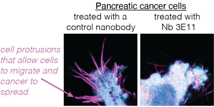 2 images of pancreatic cells side by side. The left image shows a blue cancer cell with spikes. These spikes, known as filopodia enable cancer cells to spread. The second images shows a cell with no spikes. This cell has been treated with Nb 3E11 nanobody