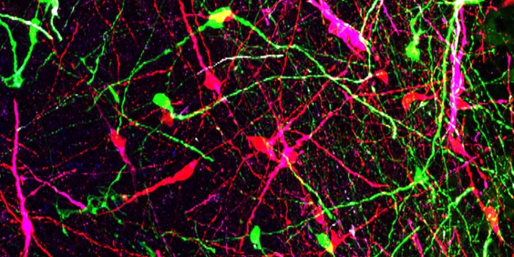 Human Fragile X neurons (red) and control neurons (green) transplanted into the mouse brain. In magenta is a immature neuron marker (doublecortin). 