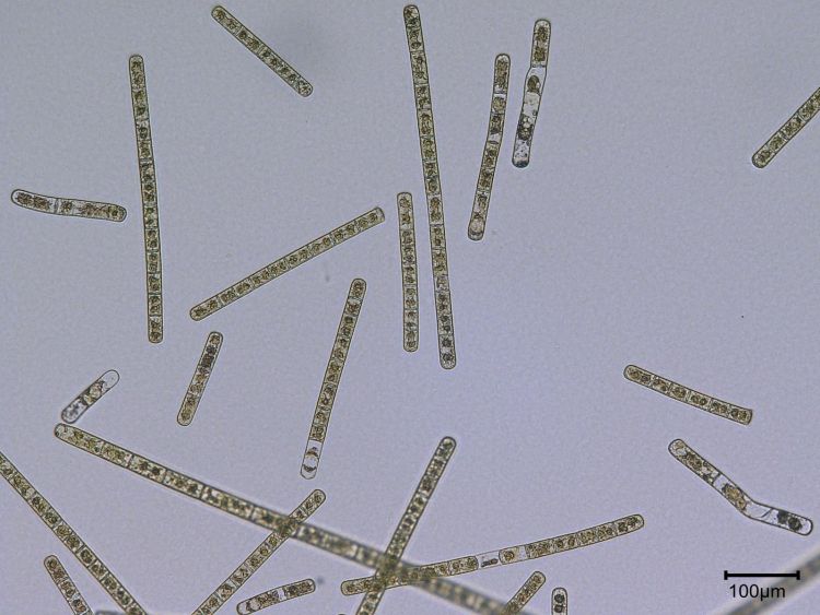 The alga Zygnema circumcarinatum (filaments